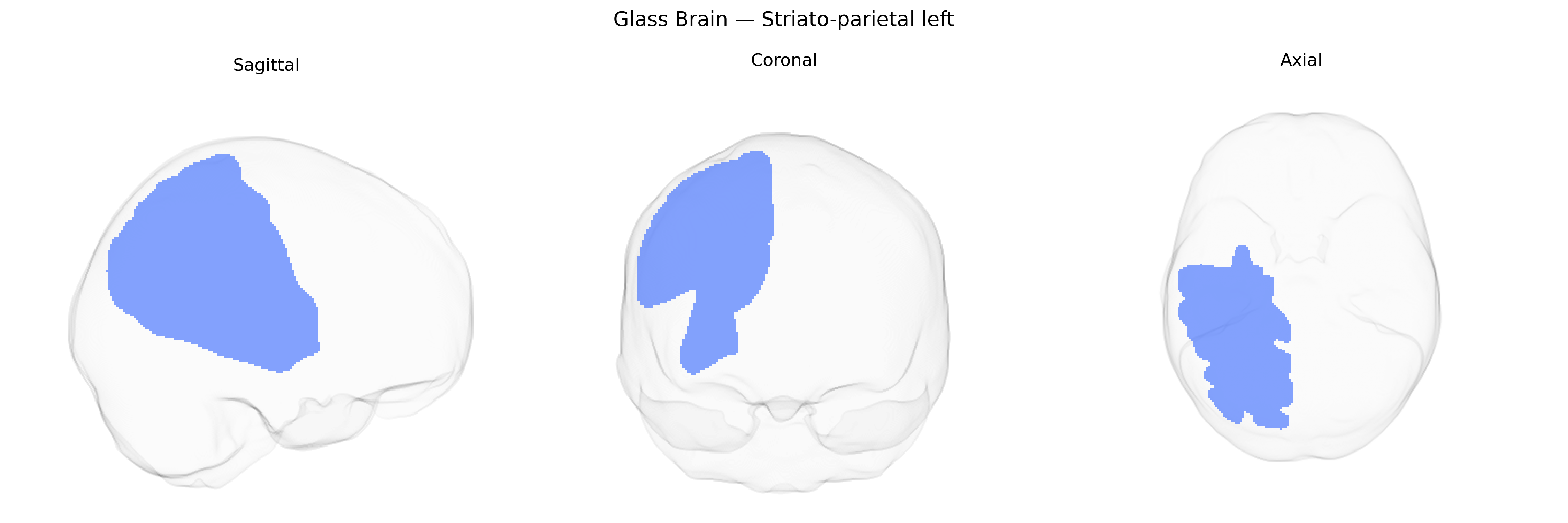 Triplanar Ghost Brain