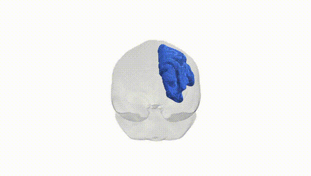 Full Brain White