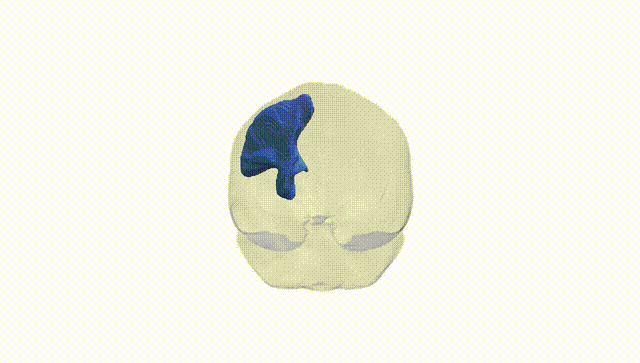 Full Brain White