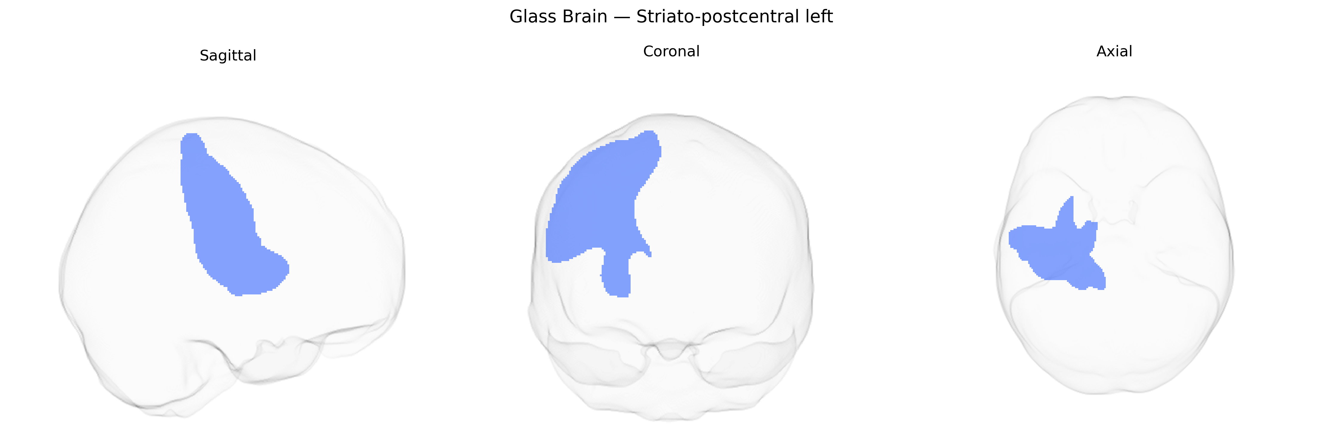 Triplanar Ghost Brain