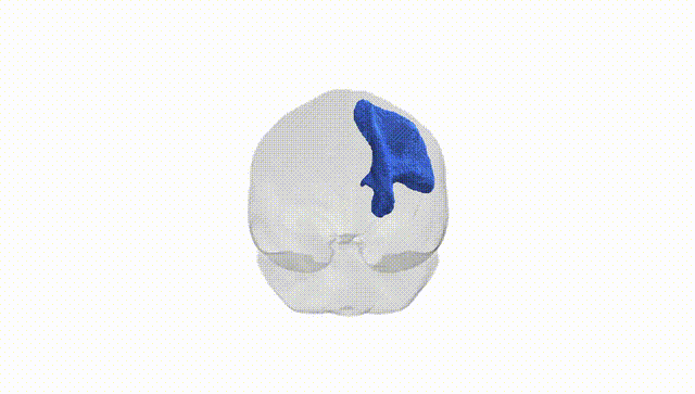 Full Brain White