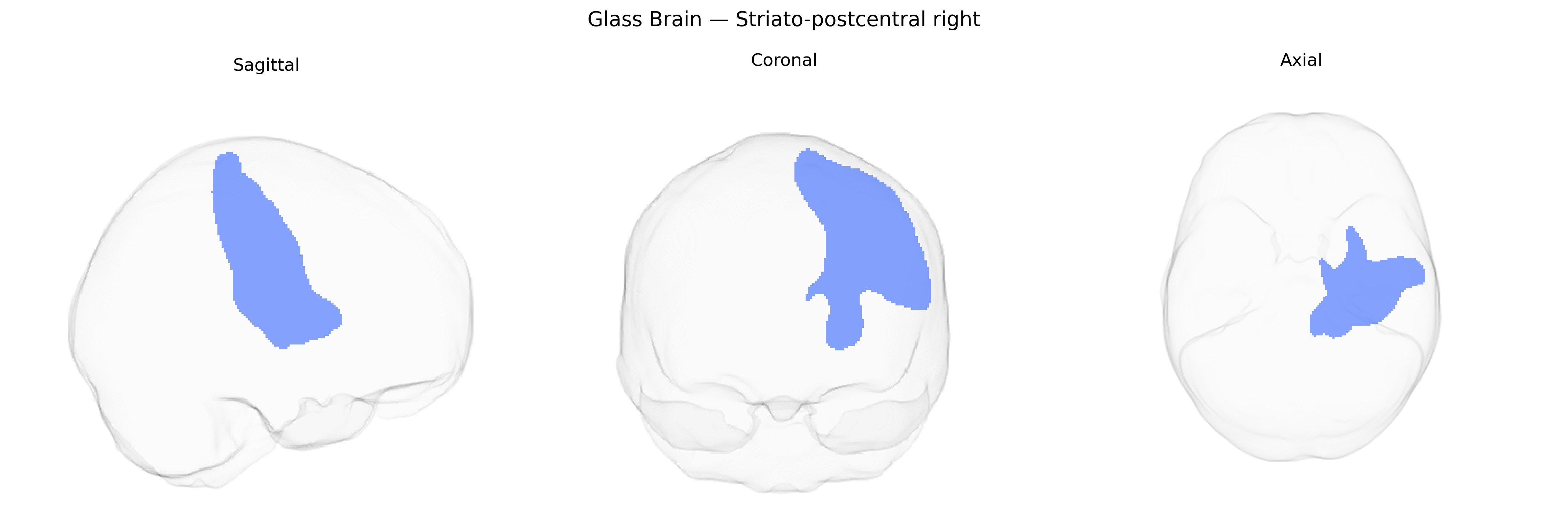 Triplanar Ghost Brain