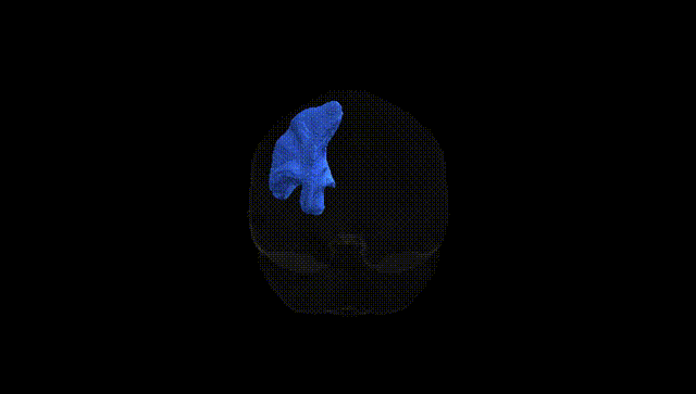 Full Brain Black
