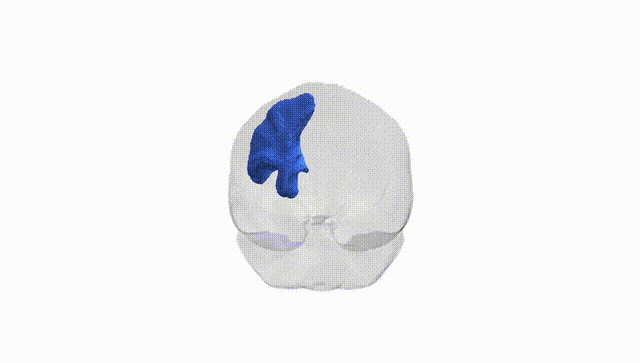 Full Brain White