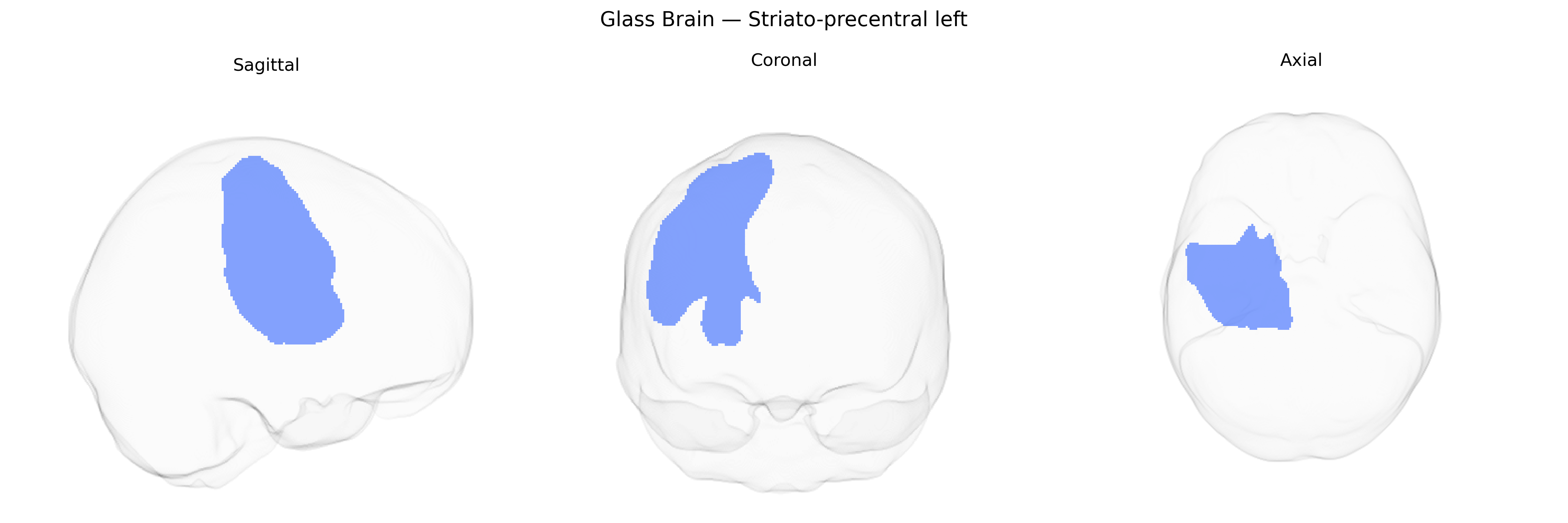 Triplanar Ghost Brain