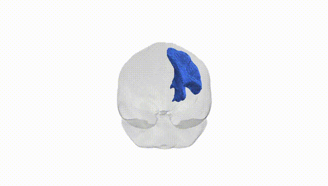 Full Brain White