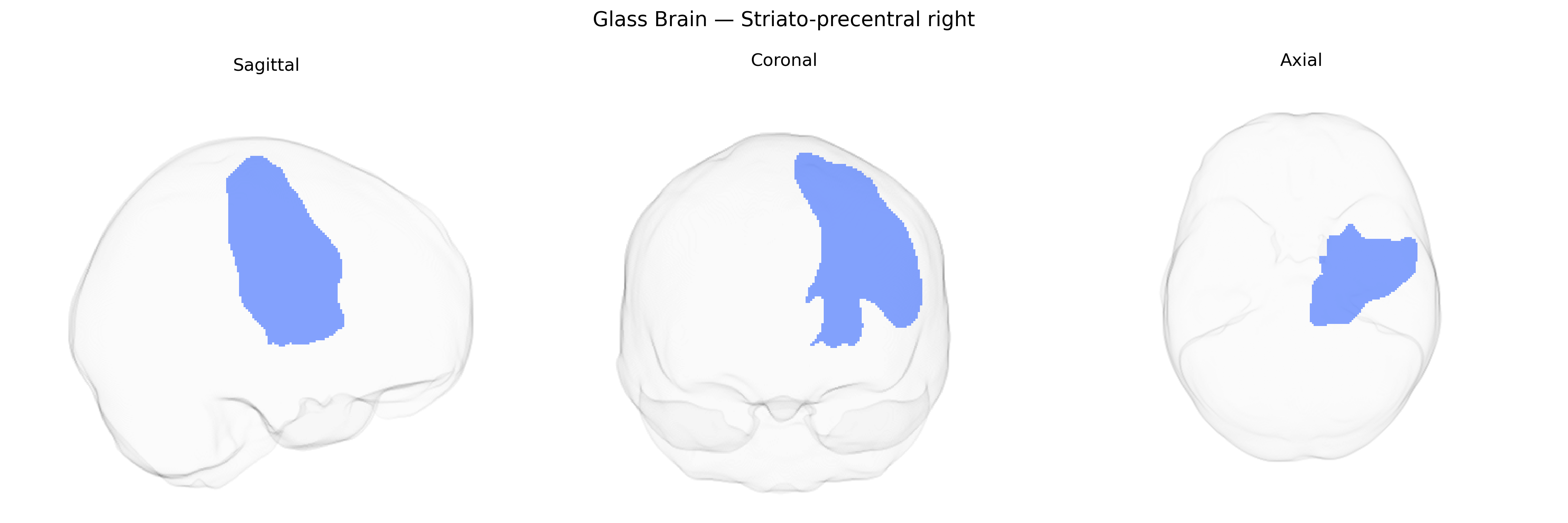 Triplanar Ghost Brain