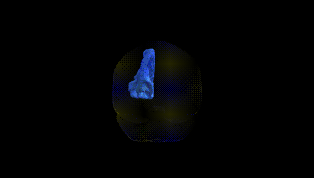 Full Brain Black