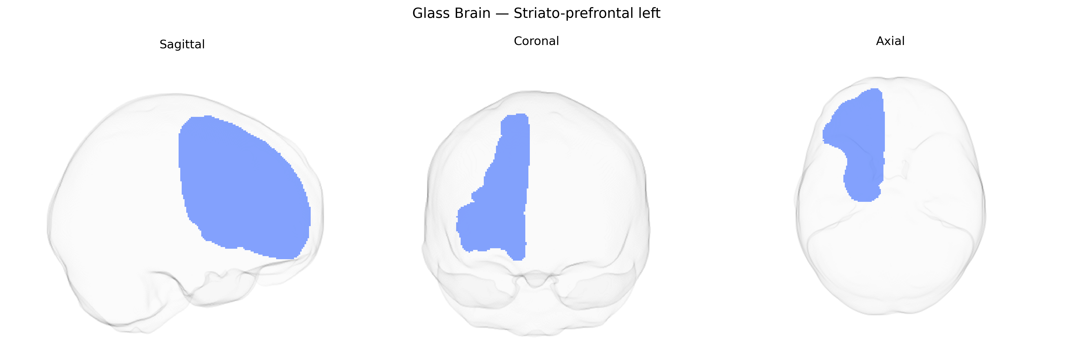 Triplanar Ghost Brain