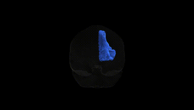 Full Brain Black