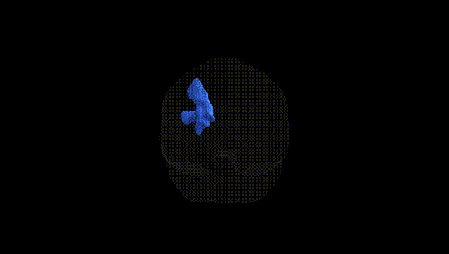Full Brain Black