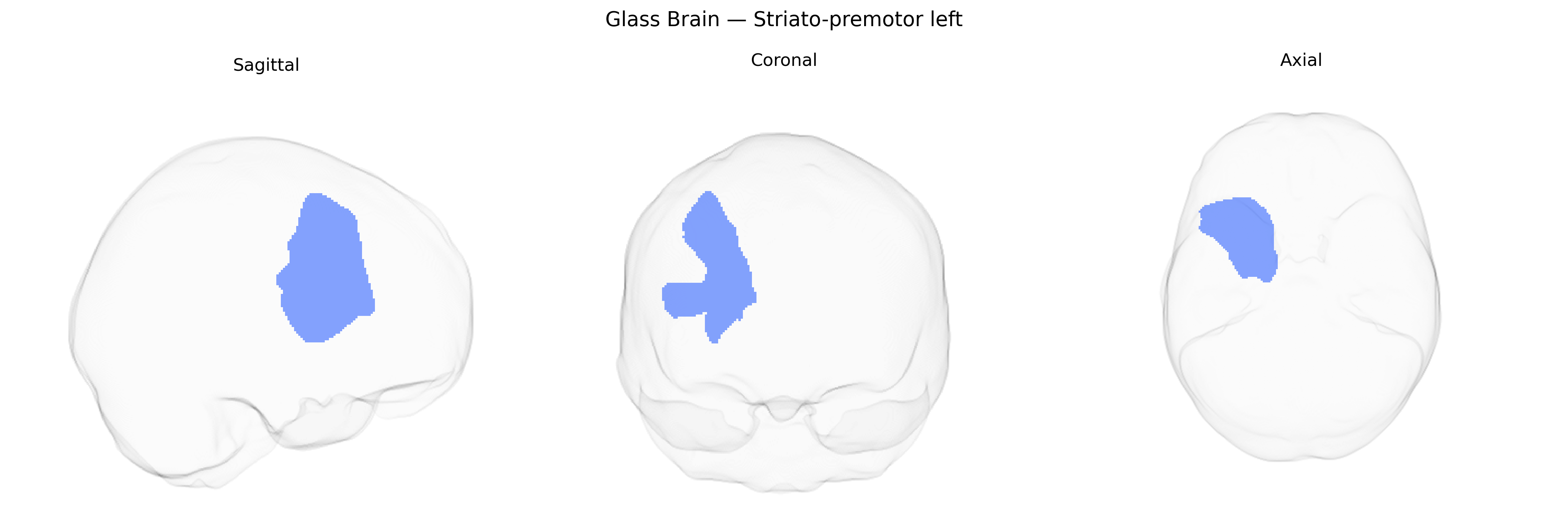Triplanar Ghost Brain