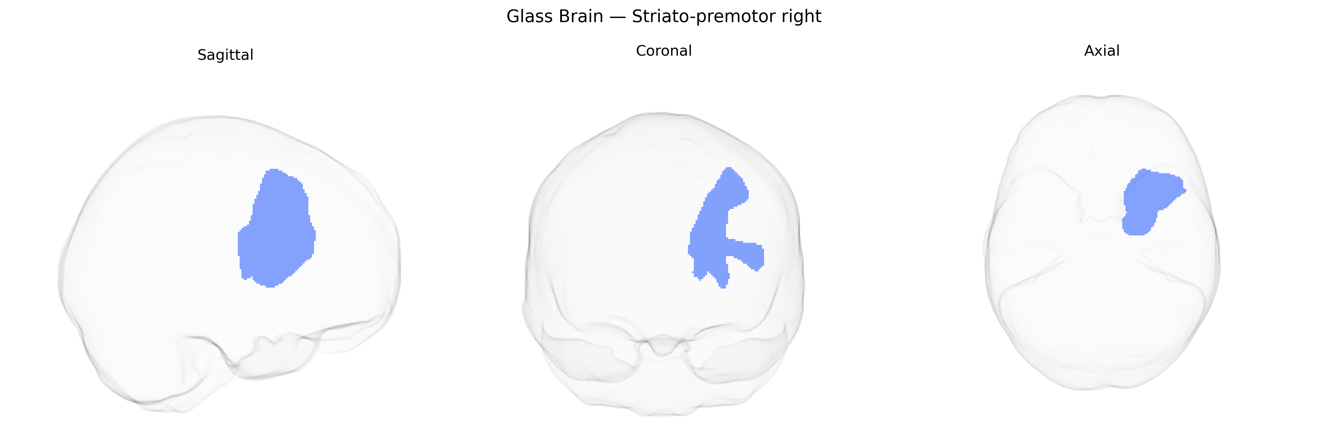 Triplanar Ghost Brain