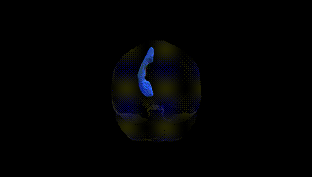 Full Brain Black