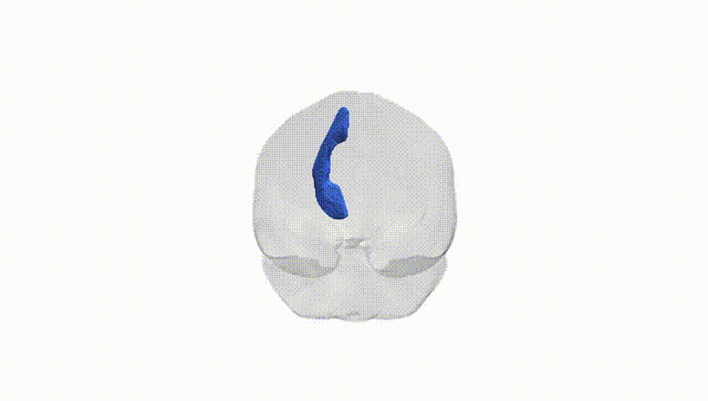 Full Brain White
