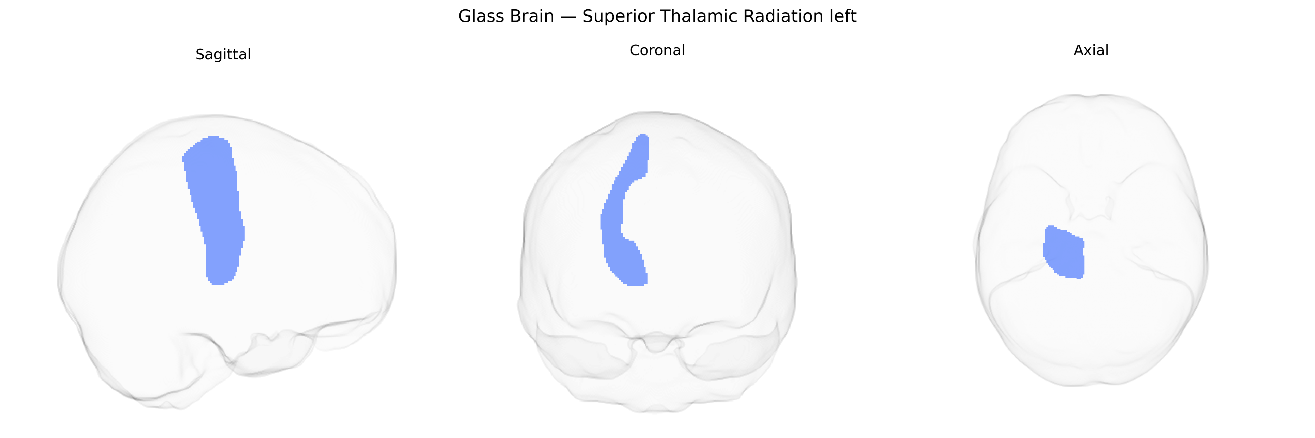 Triplanar Ghost Brain