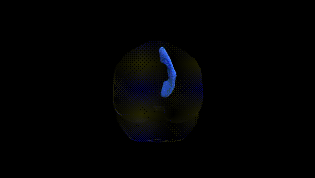 Full Brain Black