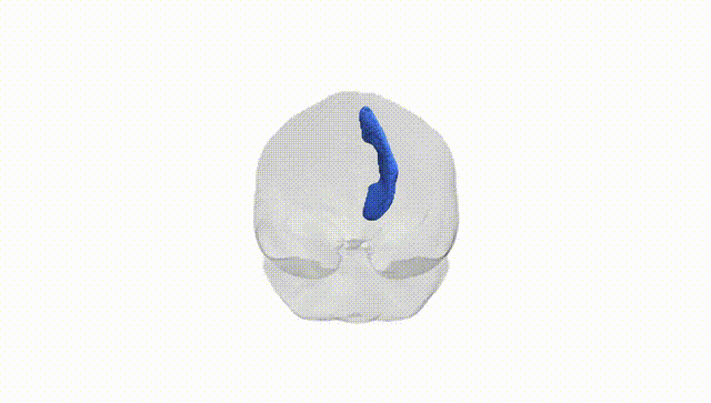 Full Brain White