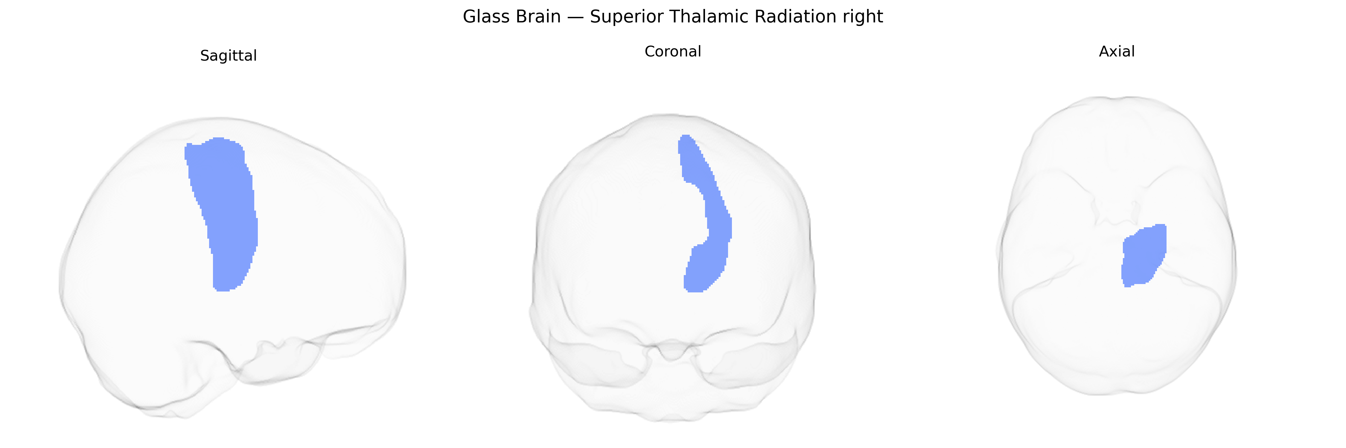 Triplanar Ghost Brain
