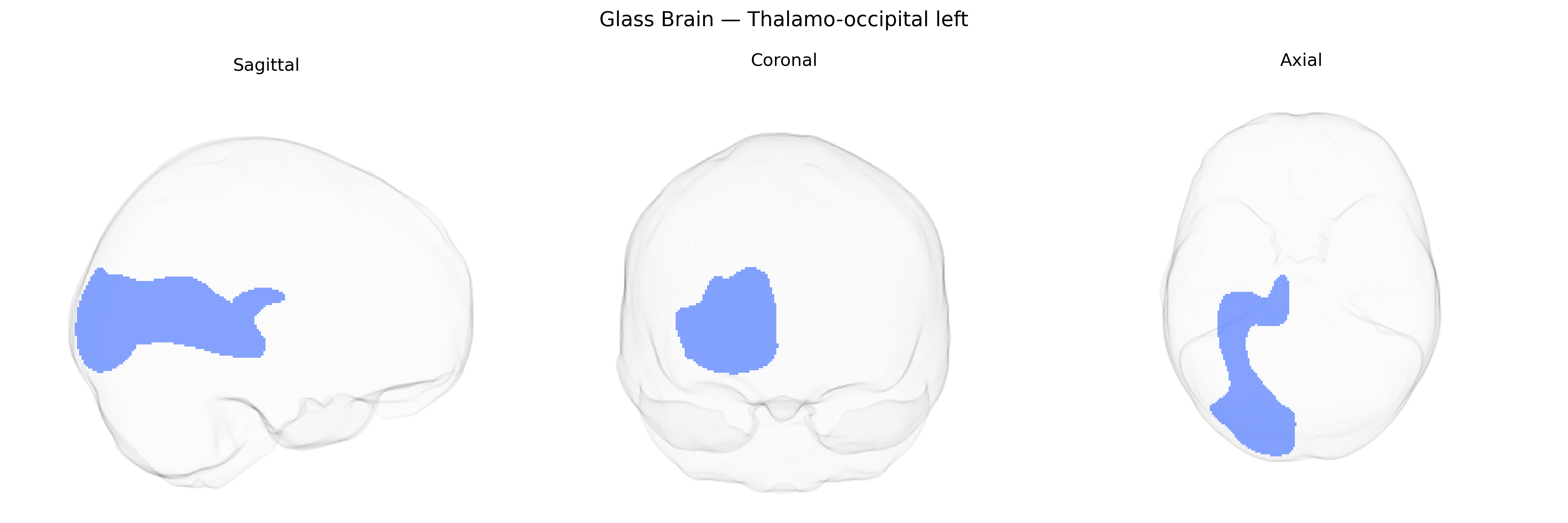 Triplanar Ghost Brain