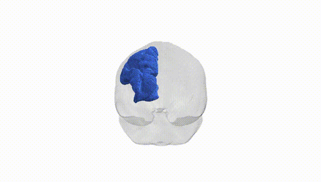 Full Brain White