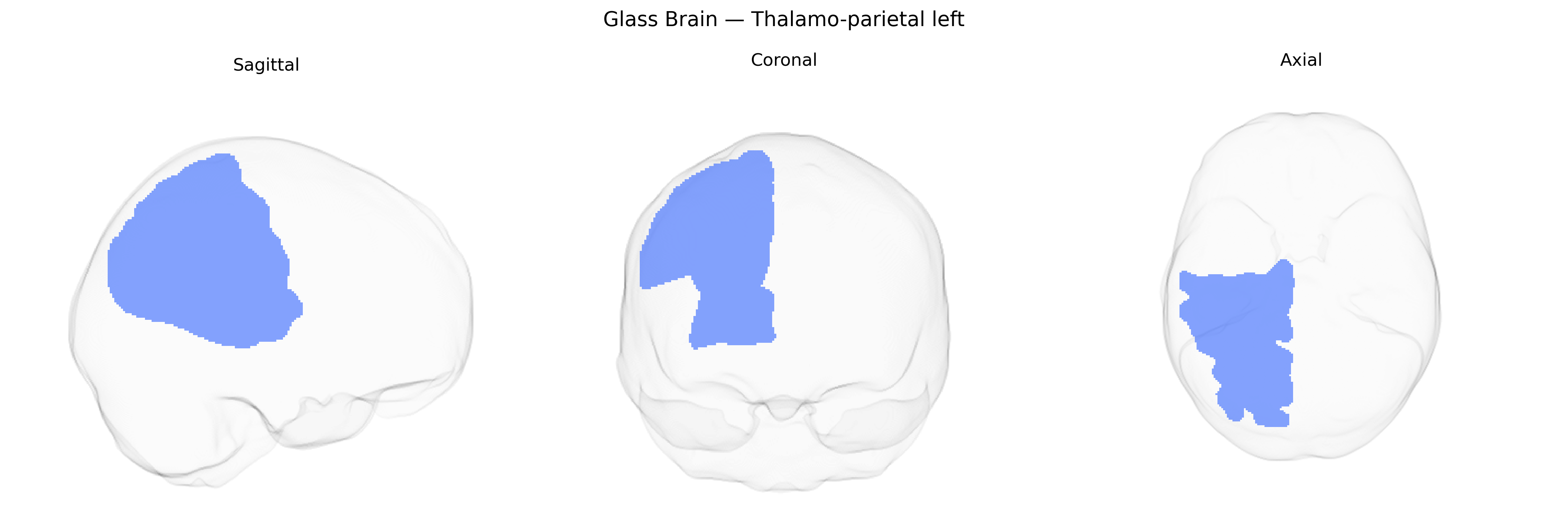 Triplanar Ghost Brain