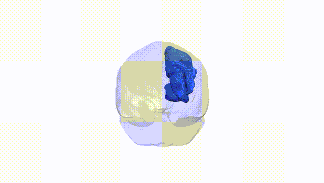 Full Brain White