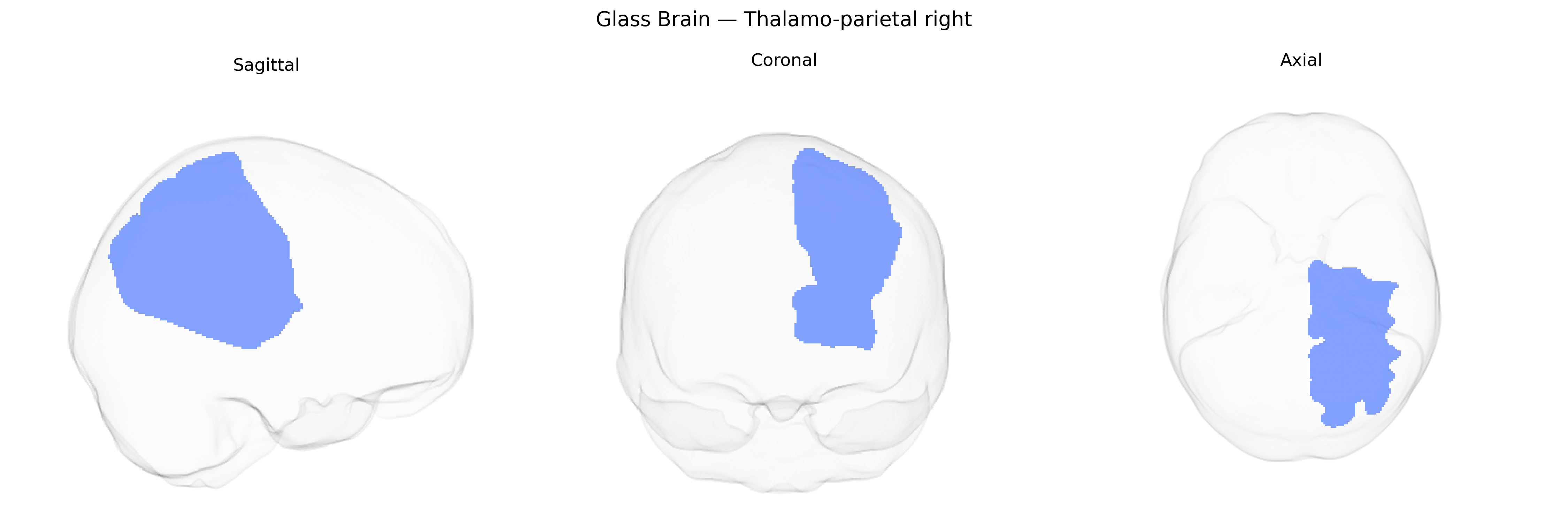 Triplanar Ghost Brain