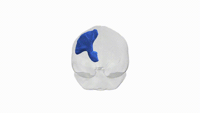 Full Brain White