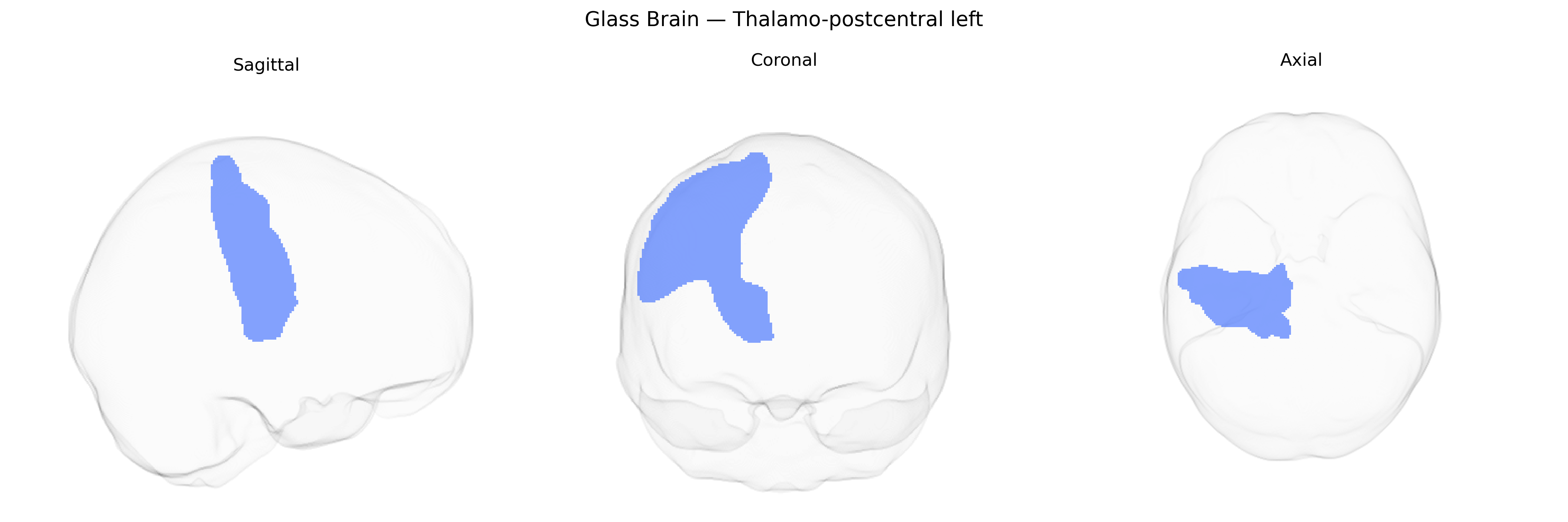 Triplanar Ghost Brain
