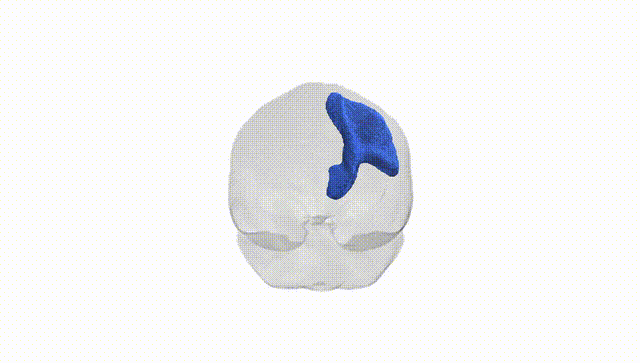 Full Brain White