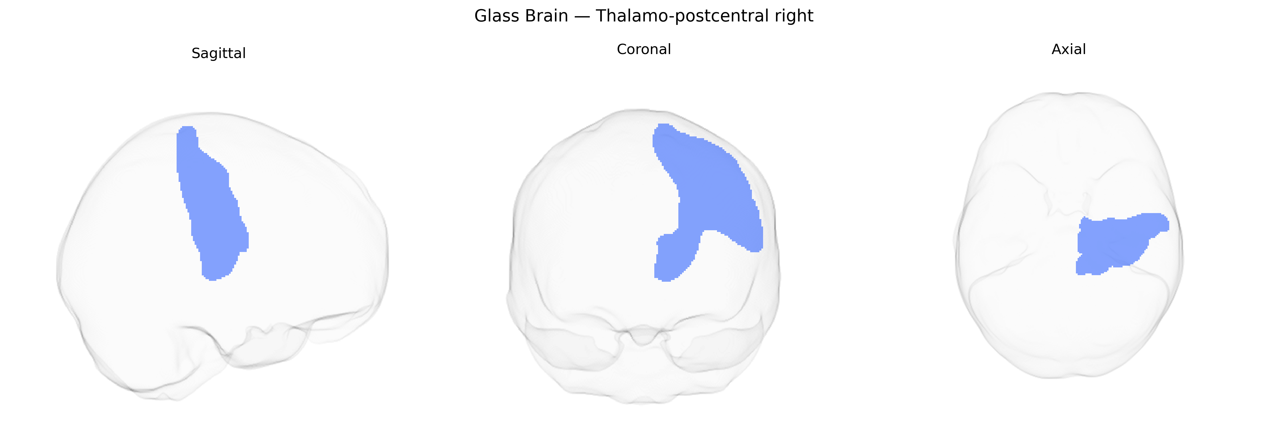 Triplanar Ghost Brain