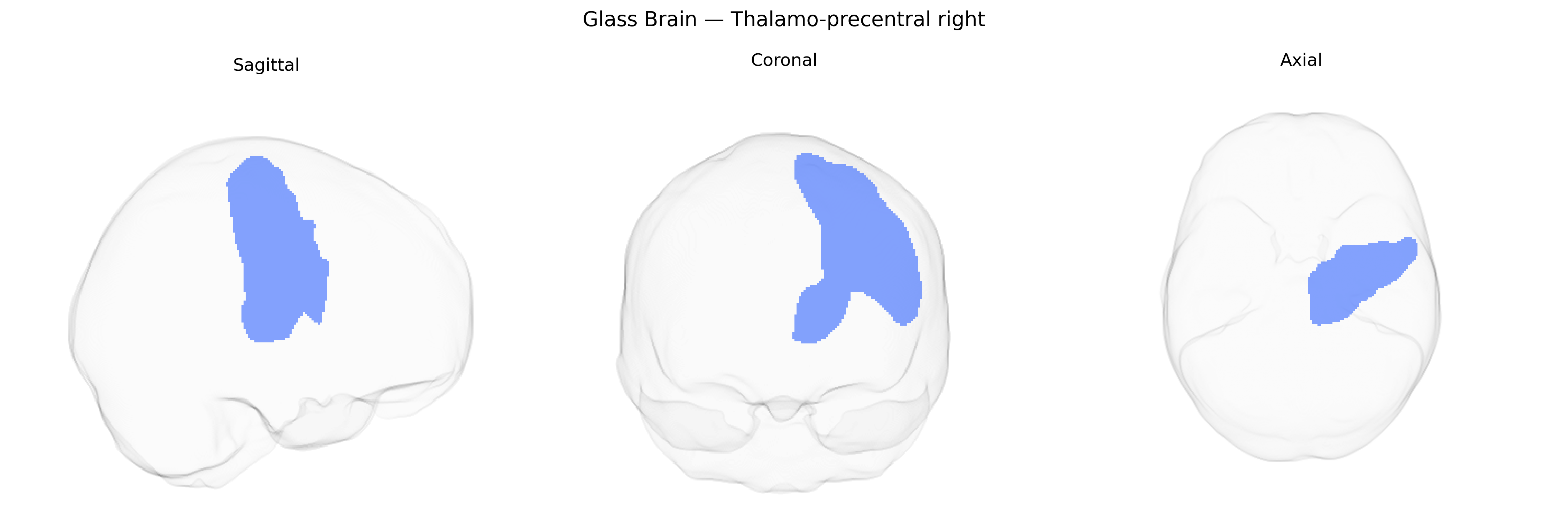 Triplanar Ghost Brain