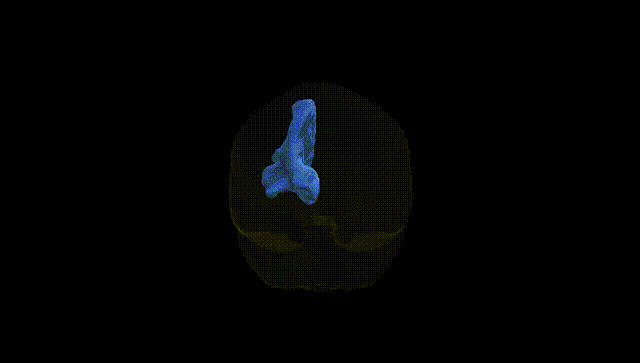Full Brain Black