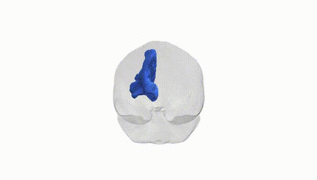 Full Brain White