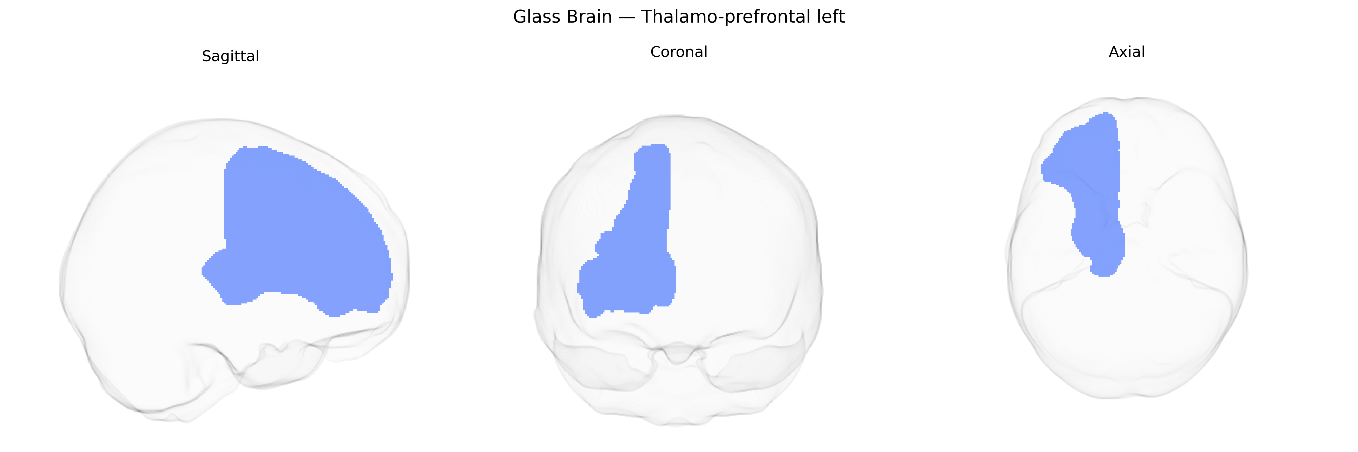 Triplanar Ghost Brain