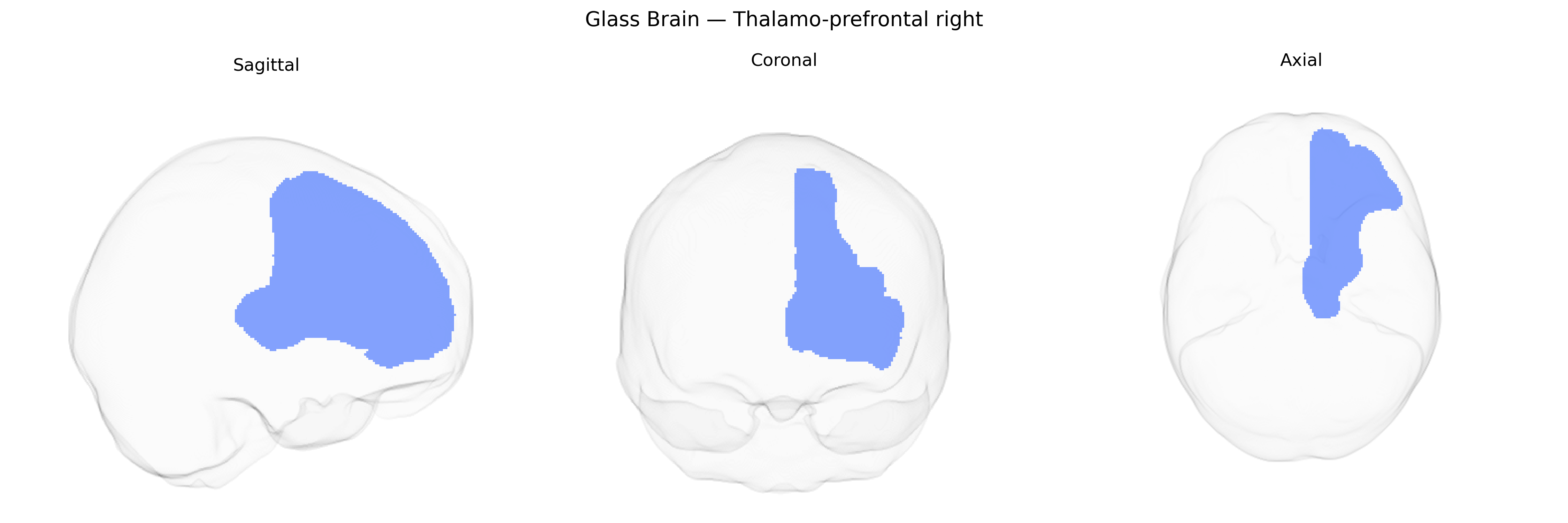 Triplanar Ghost Brain