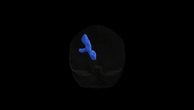 Full Brain Black