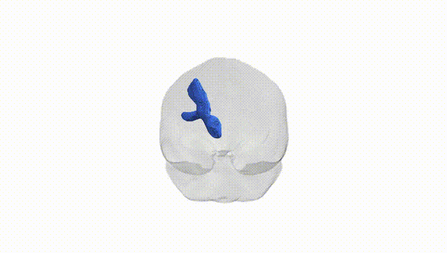 Full Brain White