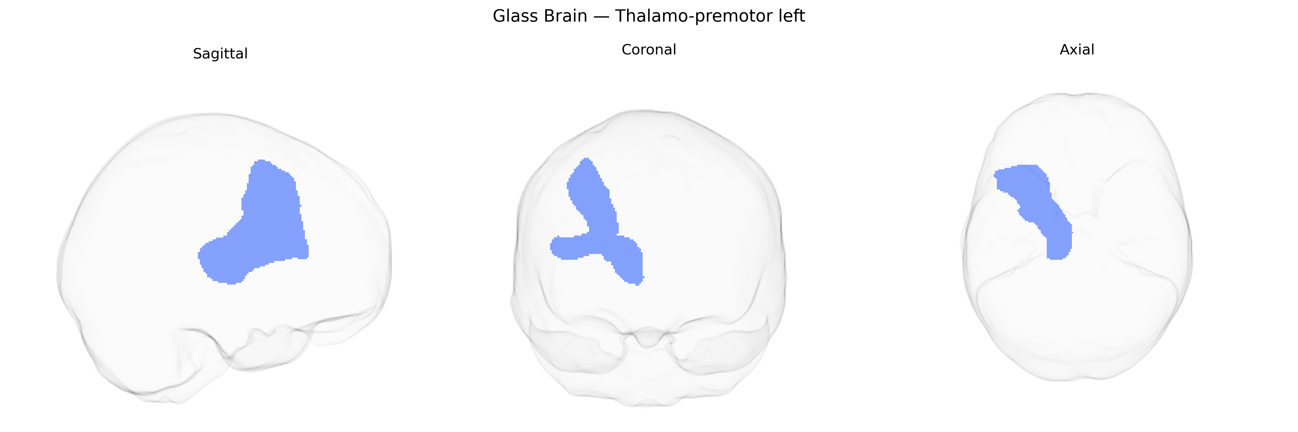 Triplanar Ghost Brain
