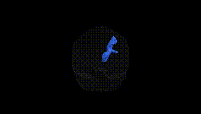 Full Brain Black
