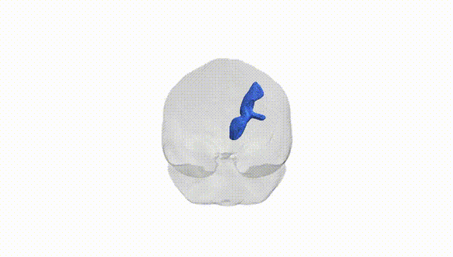 Full Brain White
