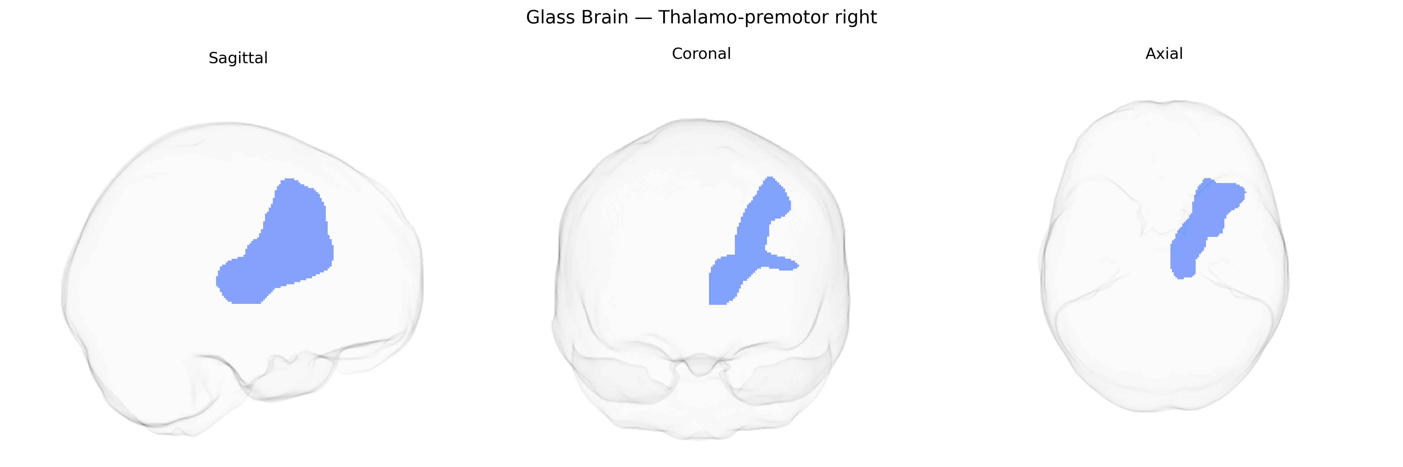 Triplanar Ghost Brain