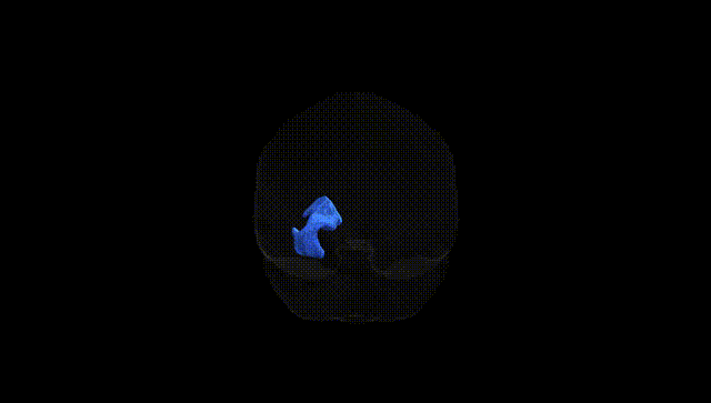 Full Brain Black