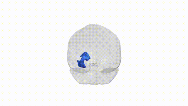Full Brain White