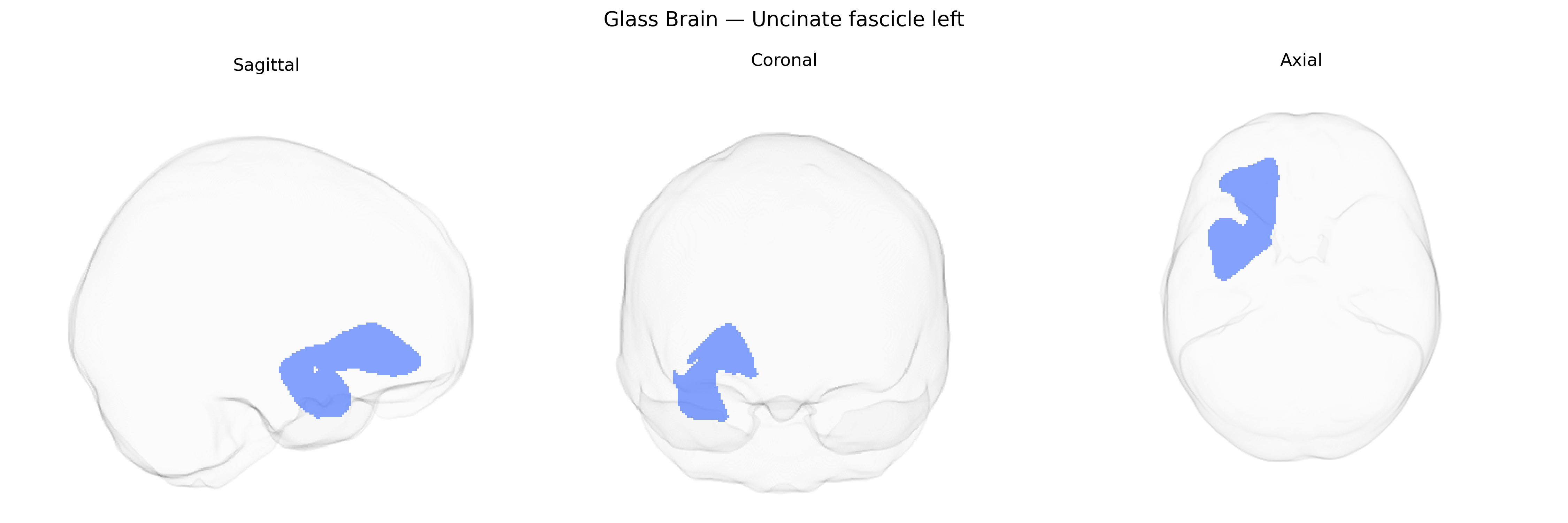 Triplanar Ghost Brain