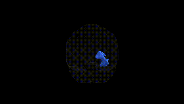 Full Brain Black