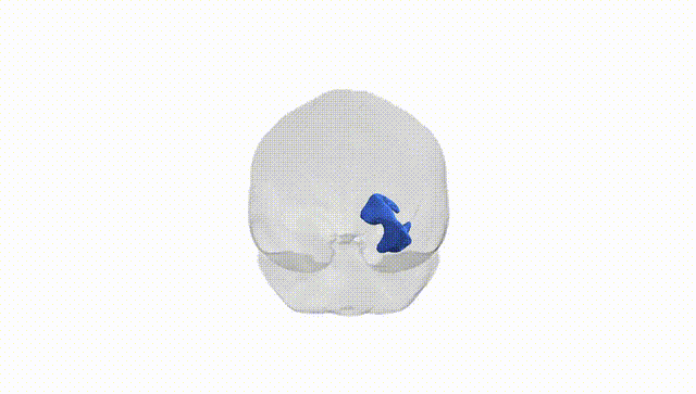 Full Brain White