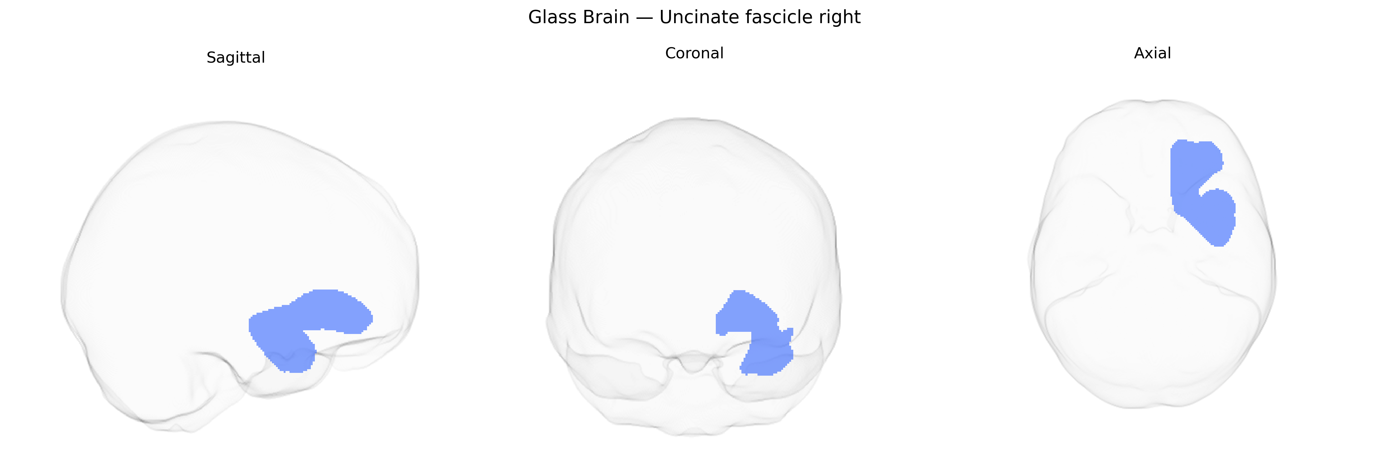 Triplanar Ghost Brain
