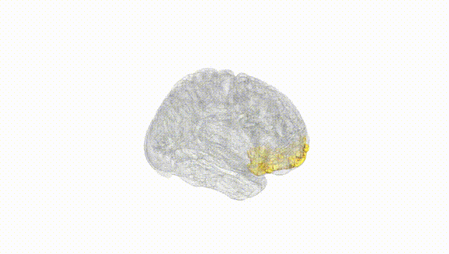 Full Brain White